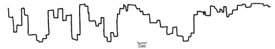  "trajectoires d'une personne dyslexique. Les lignes horizontales représentent une fixation sur un point, les lignes verticales représentent des mouvements en avant ou arrière dans le texte. Ce graphique est beaucoup plus irrégulier que le précédent"